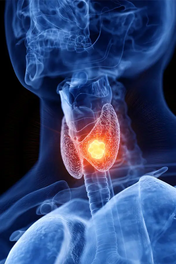 A 3D illustration of an x-ray of a human neck, highlighting the thyroid. Get help with thyroid imbalance from Tanya Zboril, NP of TBT Medical in Ottawa–Gatineau.